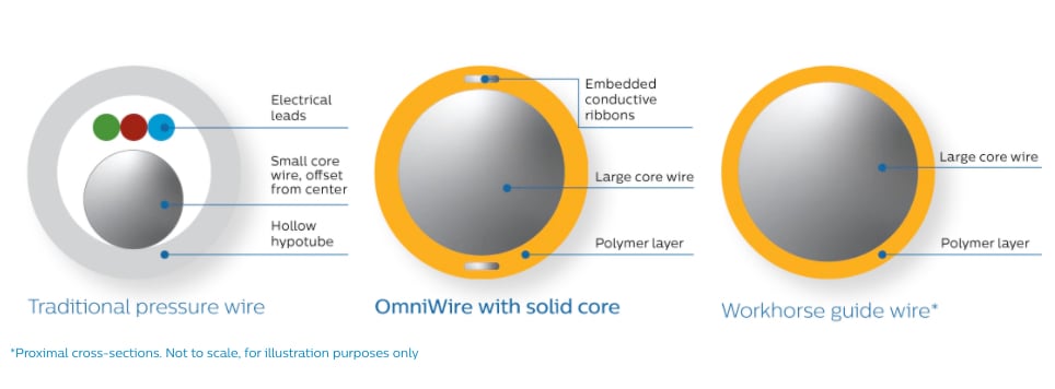 The Philips Healthcare OmniWire is the world’s first solid core fractional flow reserve (FFR) pressure wire for coronary artery interventional procedures.