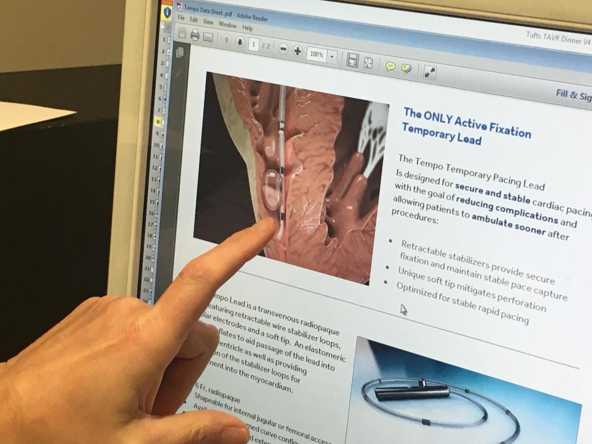 Biopace temporary pacing lead for TAVR.