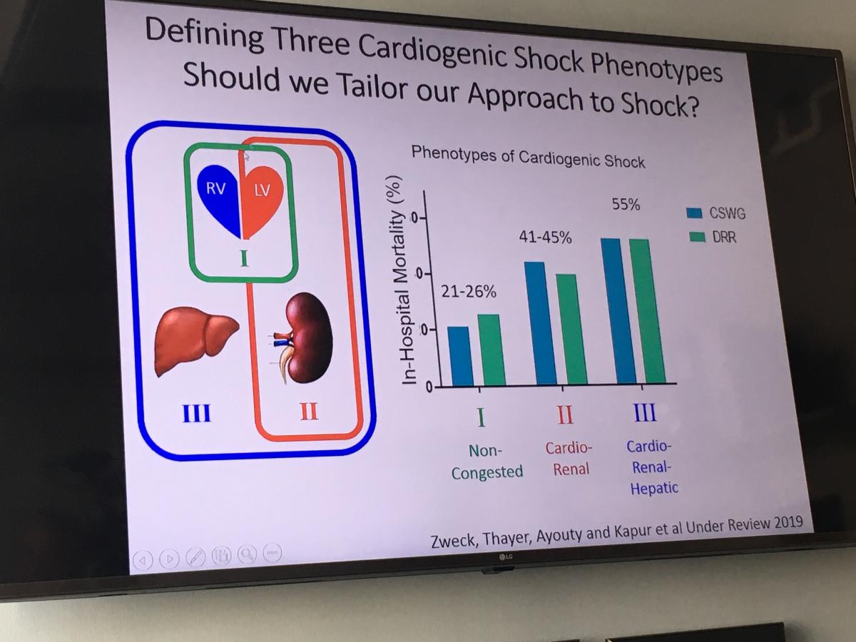 Types of cardiogenic shock