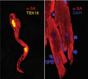 TBX18 over expression includes transdifferentiation of cardiac myocytes toward pacemaker like cells.