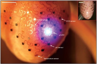 Flexible electronics attached to the heart for cardiac monitoring