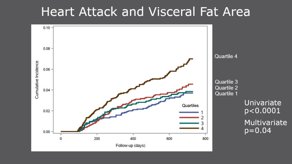 Automated deep learning analysis of abdominal computed tomography (CT) images produces a more precise measurement of body composition and predicts major cardiovascular events, such as heart attack and stroke, better than overall weight or body mass index (BMI), according to a study presented today at the 2020 Radiological Society of North America (RSNA) virtual meeting.