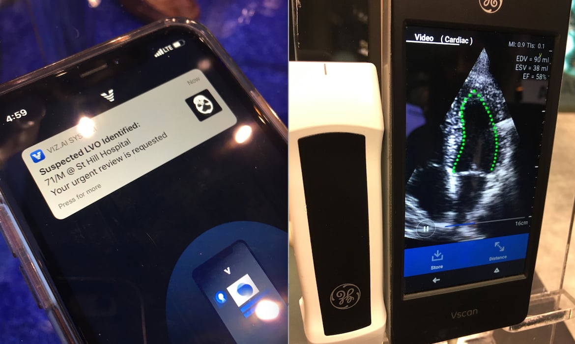 Two examples of FDA cleared AI at RSNA. Left, the Viz.AI software can automatically identify a stroke case as a CT scan is performed and immediately alert the radiologist on call to open a link to look at the case on their mobile device. Right, automated left ventricular ejection fraction using Dia's software on GE Healthcare's vScan point of care ultrasound system. Photos by Dave Fornell at RSNA 2019. 
