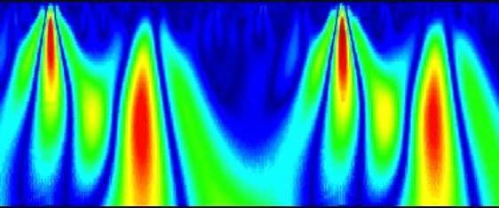 An example of the HeartSciences Myovista Wavelet ECG waveform that may offer additional information to better diagnose patients.