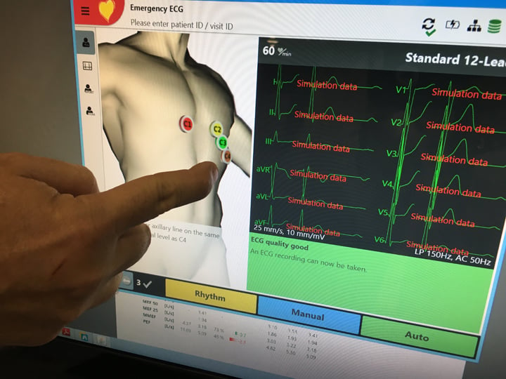 The Schiller Cardiovit FT-1 electrocardiograph (ECG) system displayed at HIMSS 2019 today. It has a 3-D rendering of a patient showing where each lead needs to be placed. The user can rotate the images on the touch screen to see where the leads go and can easily identify where any issues are when the system automatically alerts them about misplaced leads. The goal is to improve and speed ECGs using a better form of visualization than the traditional black and white 2D pictures. The system changes the lead place placements of the body rending based on the type of exam being performed using a drop down menu.