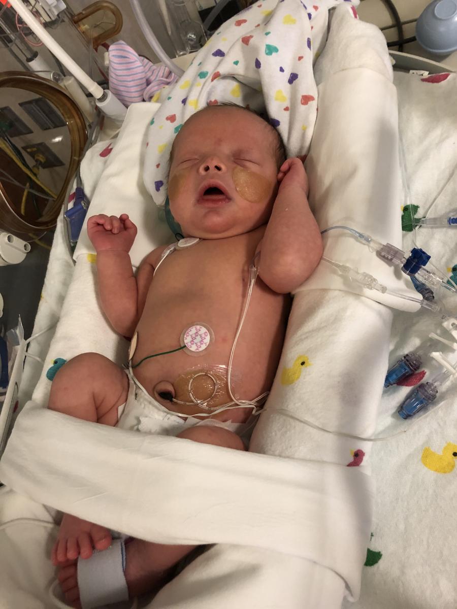 Baby delivered from COVID mother who spent 152 days in the hospital, including on ECMO support.