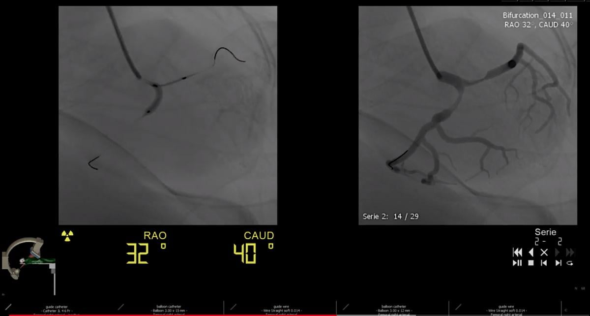 Cathi cath lab procedures simulator System in a Suitecase