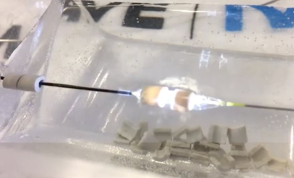 Shockwave intravascular lithotripsy demonstration showing the moment the sonic energy is emitted and causing a light flash just before shattering two calcium beads on the catheter at TCT 2019.