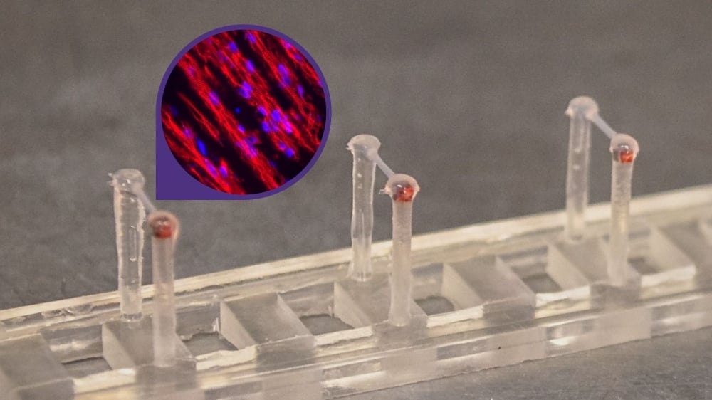 A series of miniature engineered heart tissues suspended across pillars about a quarter of an inch apart. Within each tissue is a 3-D assemblage of cardiac muscle fibers (inset). Image courtesy of Nate Sniadecki / UW ME