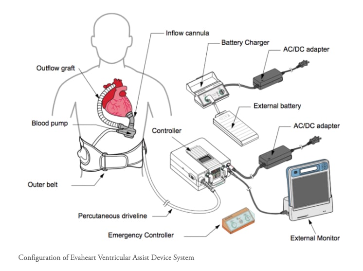 The EvaHeart2 VAD system