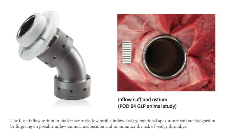 The EvaHeart2 LVAD intake is designed to reduce or eliminate thrombus formation.