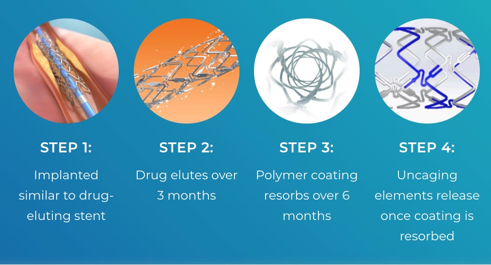 The Elixer Dynamx Coronary Bioadaptor Stent technology uses a bioresorbable polymer that dissolves after three months and disconnected joints between numerous stent segments, allowing it to articulate and share to the vessel and movement.