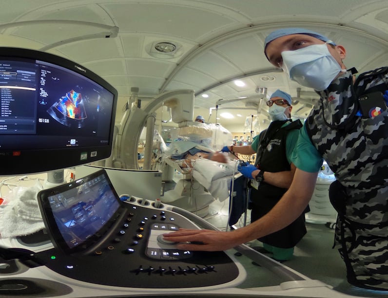 Echocardiographers helping guide a MitraClip procedure using TEE at the University of Colorado. Photo by Dave Fornell