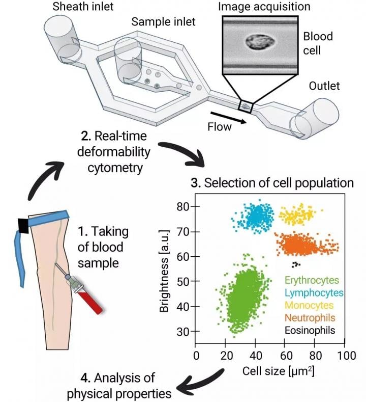  Treatment of blood samples to measure physical properties of leukocytes and erythrocytes. MPL/Guck Division. From the study How a COVID-19 Infection Changes Blood Cells in the Long Run. Reasons for long COVID