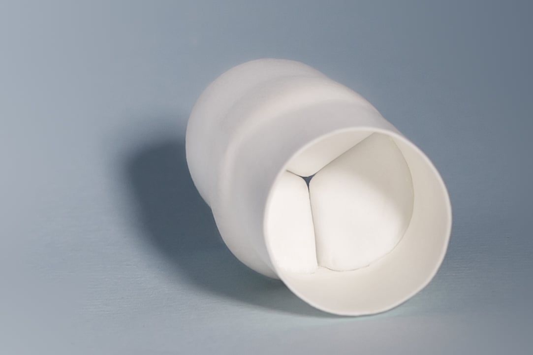 Xeltis bioresorbable pulmonary valve