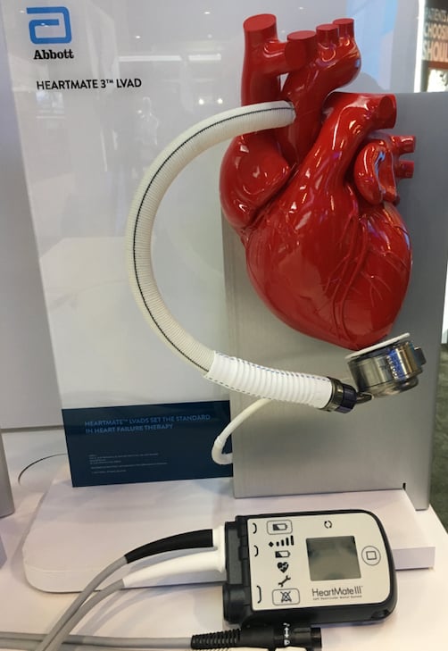 The Abbott HeartMate 3 LVAD system.