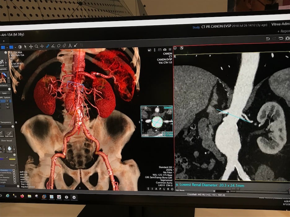 Canon's Vitrea PACS data orchestration layer uses the original data formats for images. When images are opened, they are opened in the original format. The platform allows multimodality images and advanced visualization reformatted images to be displayed together in the same viewer.