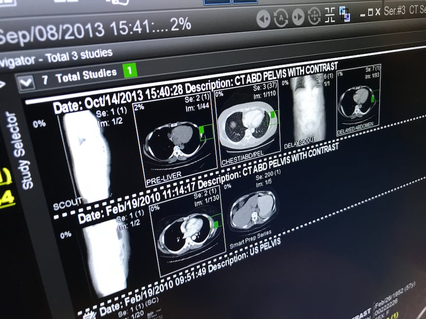 GE also showed a small tweak to improve flow of images by creating a small icon on the various exams and priors called up. A small green box on the thumbnails of the exams show where theses are located in the multiple screens the radiologist currently has open. They can click on that exam they have interest in and it auto populates they main screen for closer review. #HIMSS #HIMSS21