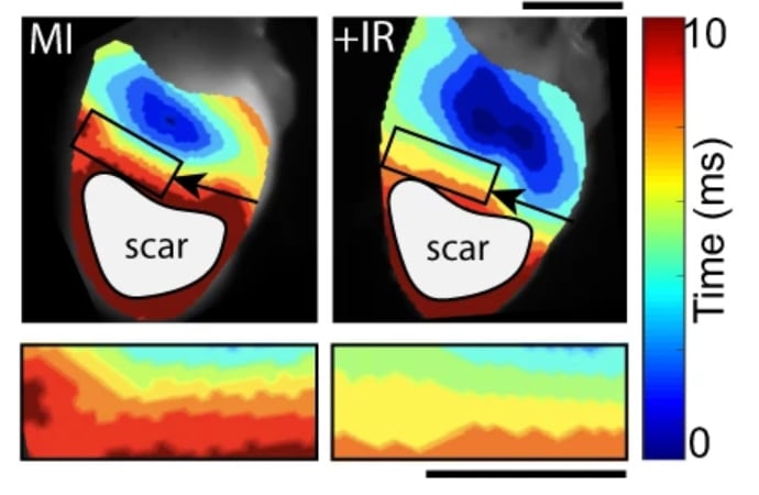 Representative ventricular activation maps from control myocardial infarction (MI, left) and irradiated MI (MI+IR, right) mice at 8 weeks post-MI and 6 weeks post-IR. Black arrows point to location of left anterior descending (LAD) artery ligation. Black box denotes approximate 2 mm border zone at the scar/myocardium interface. Regions of scar that were epicardially stimulated, but did not capture are denoted by gray circles. Magnified isochrones in the border zone region used to calculate transverse conduction velocities.
