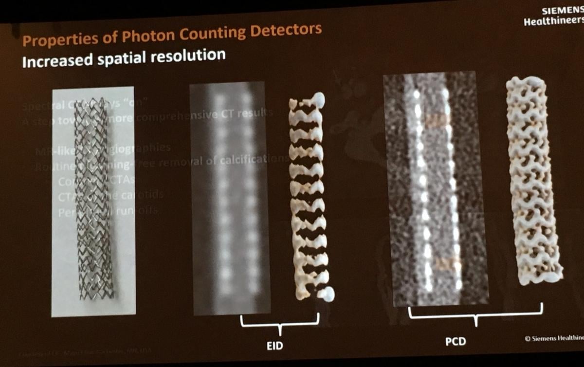 Example of how the photon-counting CT detector being developed by Siemens can improve the resolution of a coronary stent.
