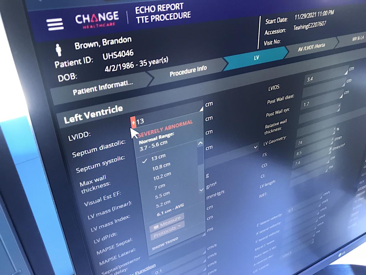 Change Healthcare CVIS echo report with an automated flag that the measurements are abnormal.  