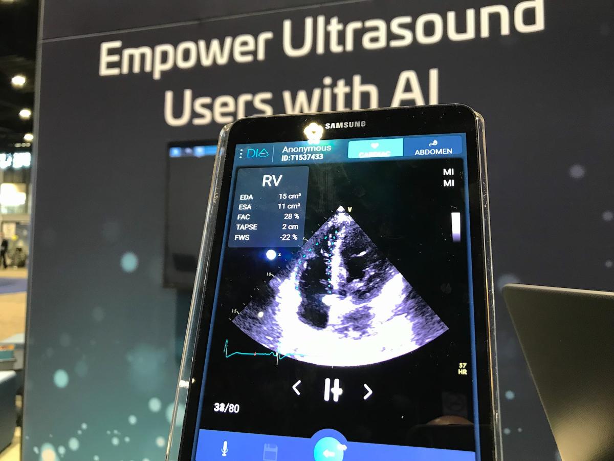 The echo AI automation offered by Dia has been adopted. by several vendors for deep integration into imaging and reporting systems. This image shows Dia's automated measurements.