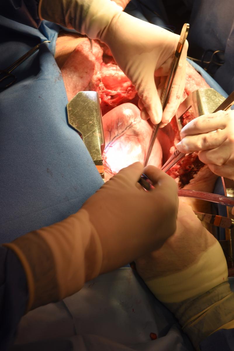 The pig heart being removed from the pig for use in the human heart transplant procedure. This is the first human to receive a pig heart transplant. #Pigheart