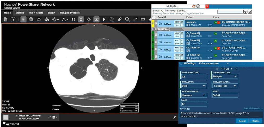 Nanox.AI Connects to Nuance Precision Imaging Network to Improve Early Detection of Chronic Diseases with Workflow-integrated AI - Vimarsana News