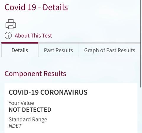 COVID-19 swab test kit for a healthcare worker in the Chicago area. Photo by Sarah Plos Viray, RN.