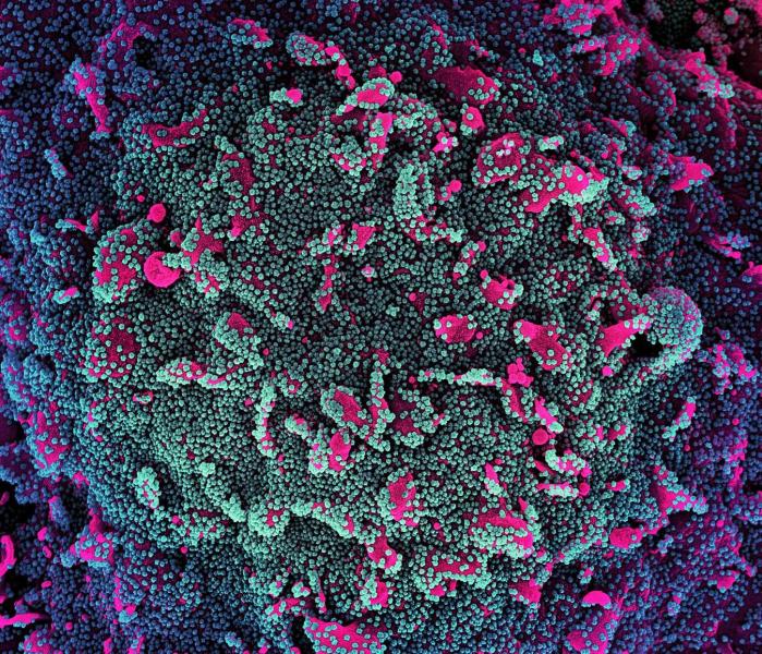 Coronavirus SARS-CoV-2 colorized scanning electron micrograph of a cell (pink) heavily infected with SARS-CoV-2 virus particles (teal and purple), isolated from a patient sample. Image courtesy of NIAID.