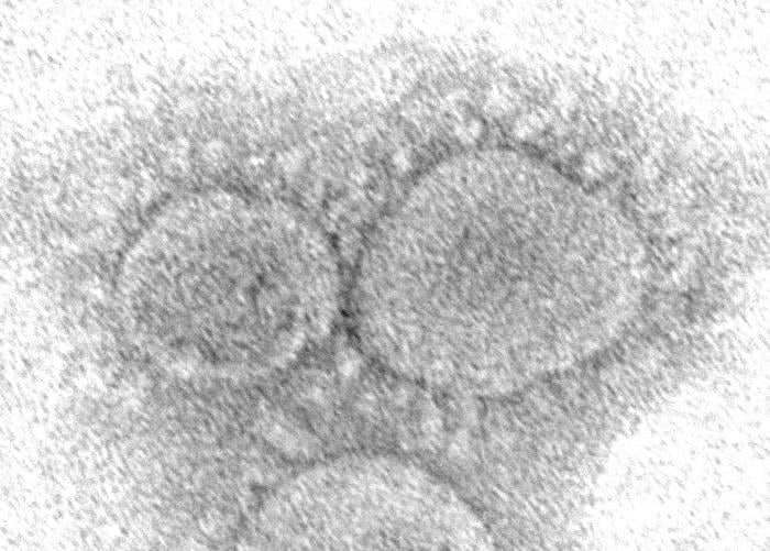 The SAR-CoV-2 virus seen under an electron microscope. Image from the CDC/Hannah A. Bullock and Azaibi Tamin.