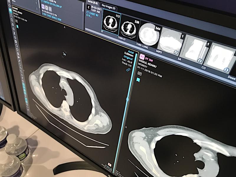 A radiology workflow improvement shown by several vendors at HIMSS, including this image from Change Healthcare. The system offers a thumbnail manu at the top of a current exam to automatically create new views of the data set with one click. #HIMSS #Radiology #radiologyworkflow #HIMSS21
