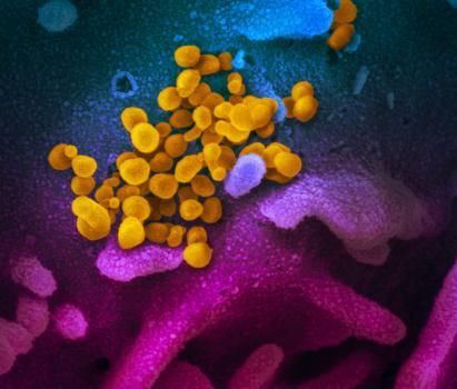 This scanning electron microscope image shows SARS-CoV-2 (yellow)—also known as 2019-nCoV, the virus that causes COVID-19—isolated from a patient in the U.S., emerging from the surface of cells (blue/pink) cultured in the lab. Photo by NIAID-RML.