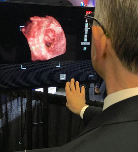 This was a really interesting a href="https://www.dicardiology.com/content/echopixel-introduces-3-d-holographic-intraoperative-software"> new technology shown by EchoPixel at TCT 2019 creates live holograms in the cath lab for procedural guidance.</a> It takes live transesophageal echo (TEE) in the cath lab and projects the image as true 3-D holograms. The special display screen does not require the user to wear 3-D glasses. The interventional cardiologist can use hand movements and a fo#TCT2019 #TCT #TCT19