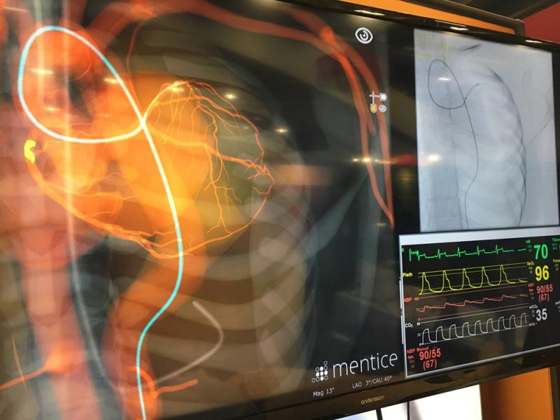 #TCT2019 #TCT #TCT19 This is a realistic cath lab simulator training set up shown by Mentice. The patient has respiratory chest motion, eyes blink and it allows for radial or femoral catheterization. The simulator allows for PCI training. When not used for cath training, the patient simulator can be used by other hospital staff training or EMS training.