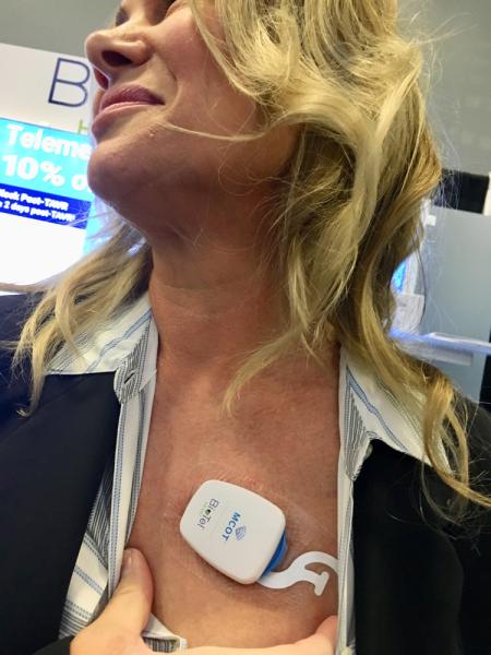 #TCT2019 #TCT #TCT19 This is the Biotel remote telemetry cardiac monitor. The simple adhesive patch sticks to the patient's chest and the patient carries a cell phone device that relays the data in real-time. An algorithm monitors the data and issues alerts to physicians if measures fall outside set parameters. The monitor was featured in a University of Colorado study presented at TCT where it was used to remotely monitor TAVR patients who did not have a pacemaker. 