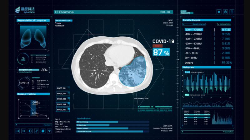 Artificial intelligence (AI) radiology company InterVision has modified its CT Pneumonia software to help auto detect COVID-19 on computed tomography scans. The technology was put into use in China early on in the epidemic to help screen large volumes of patients and flag those with radioman symptoms for stat reads. #SARScov2