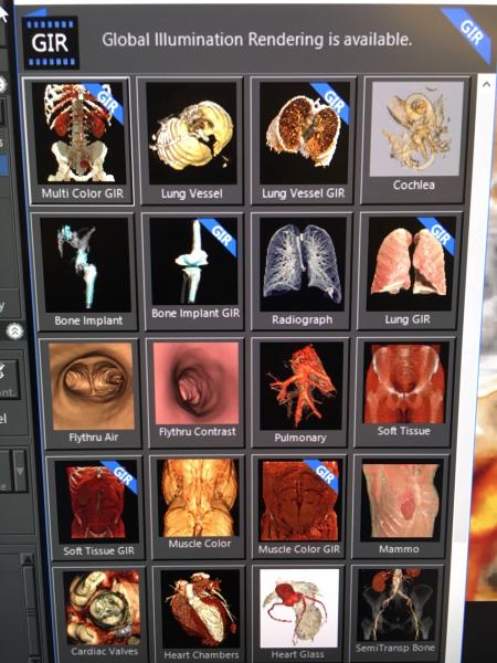 Examples of Canon's computed tomography (CT) Global Illumination photo-realistic rendering advanced visualization software. #SCCT #SCCT2019