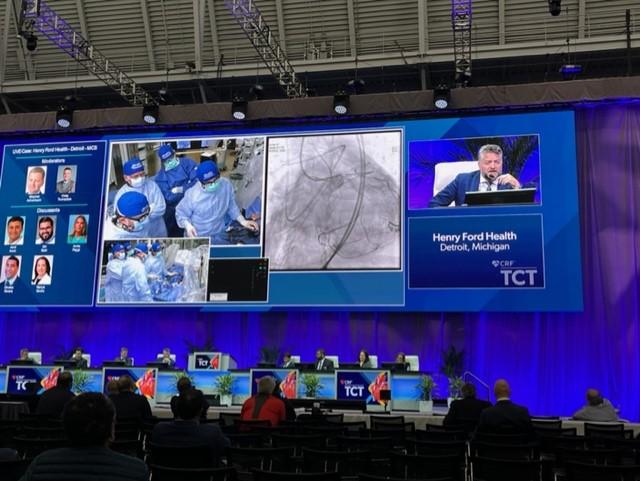 Cardiologists from Henry Ford Hospital in Detroit, MI presented a live case in the Coronary Theater on Sept. 19 during TCT 2022. 