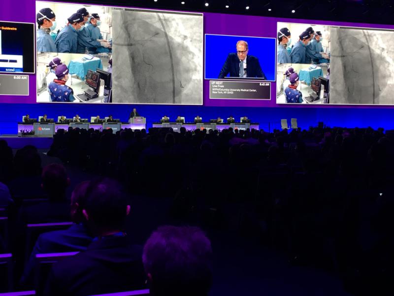 #TCT2019 #TCT #TCT19 A live case presentation in the main arena at TCT 2019.