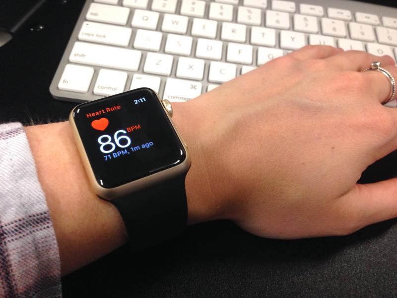 Apple Watch used for tracking patient arrhythmias using an artificial intelligence-based algorithm 