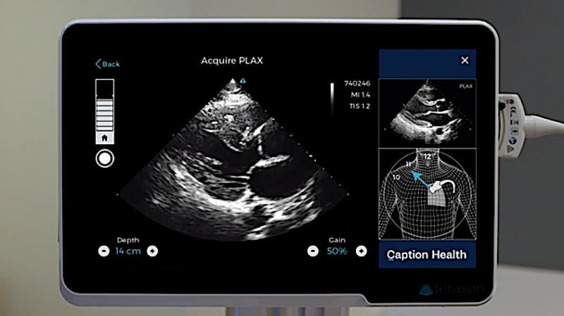 In February 2020, the U.S. Food and Drug Administration (FDA) cleared artificial intelligence software to assist in the acquisition of cardiac ultrasound images. The Caption Guidance software from Caption Health is an accessory to compatible diagnostic ultrasound systems and uses artificial intelligence to help the user capture images of a patient’s heart that are of acceptable diagnostic quality. It is aimed at point of care ultrasound (POCUS) exams, where users may not be regular sonographers.
