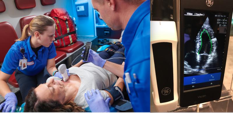 GE is integrating artificial intelligence into most of its imaging and information technology software. AI can aid fast critical care decision making. Above left is the vScan Air wireless point-of-care ultrasound system. It integrates AI for immediate, automated assessment of a patient's ejection fraction, right.