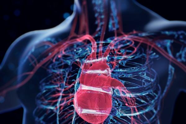 angiography, PCI, FFRangio