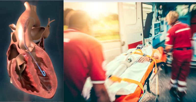 The Abiomed Impella percutaneous heart pump was shown in the NCSI study to greatly improve survival of acute myocardial infarction with cardiogenic shock (AMICS), raising survival from 50 percent to 71 percent. Ambulance image from Getty Images.
