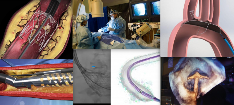 interventional cardiology, cath lab videos