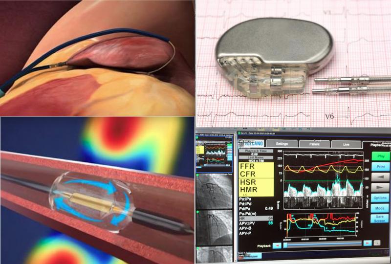 Some of the top technology news from ACC 2021. Top left, the LAAOS III trial showed benefit when surgeons seal off the LAA during other open heart procedures. Bottom left, the ReCor Paradise renal denervation system helped lower blood pressure in patients who did not respond to medication. Top right, for patients with both heart failure and AFib it makes no differences is therapy is focused on controlling the heart rhythm or heart rate. Bottom right, the FLOWER-MI trial found no benefit to FFR-guided PCI.