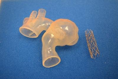 Children's Hospital of Michigan, Ariana Smith, aortic aneurysm, 3-D printing