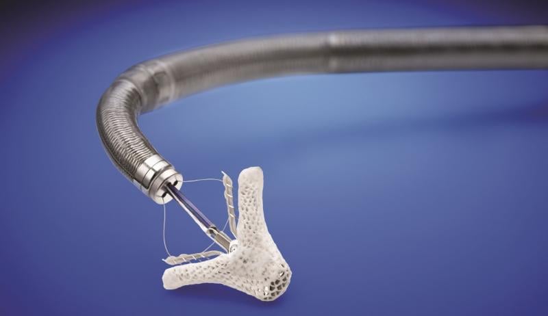 The top cardiac technology news item in March was the FDA clearing the MitraClip for use in heart failure patients with functional mitral regurgitation based on the very positive results of the COAPT Trial.