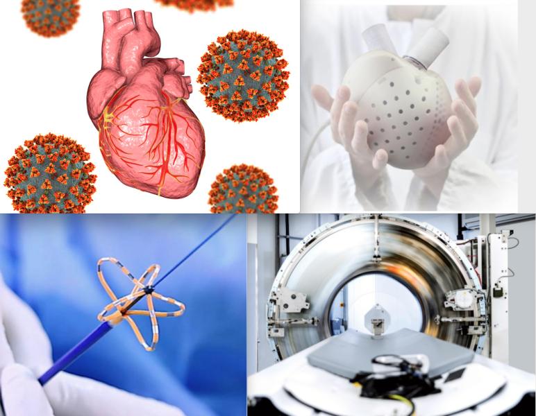 The most popular stories in 2021 included several on impact of COVID-19 on cardiology, the use of the Carmat artificial heart, advances in pulsed field ablation in electrophysiology and the FDA cleanace of the first photon-counting CT scanner.